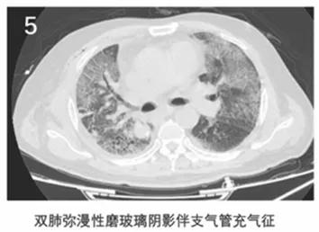 全球视角下的新冠病毒最新表现观察与解析